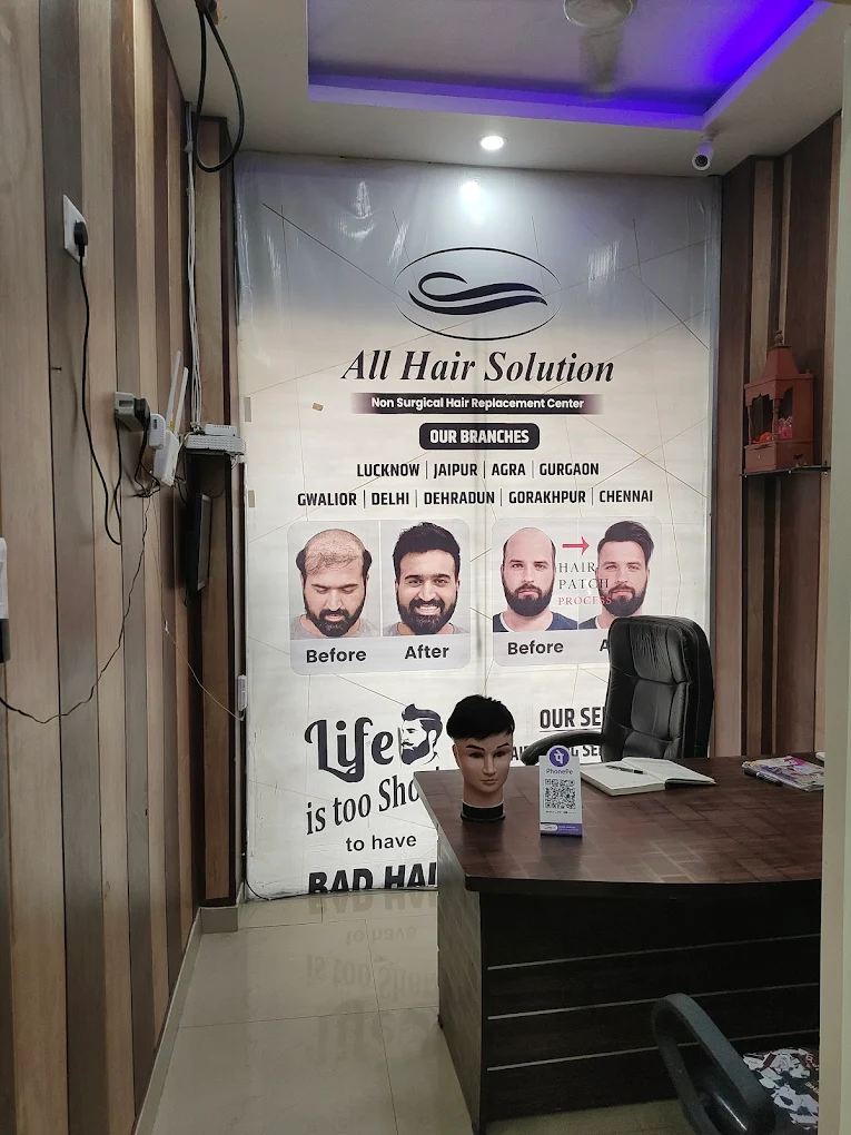 Best Hair Replacement Service in Lucknow